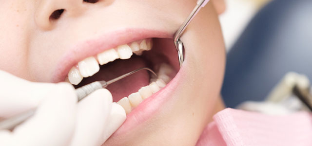 お子様の歯並びがきになる方へ