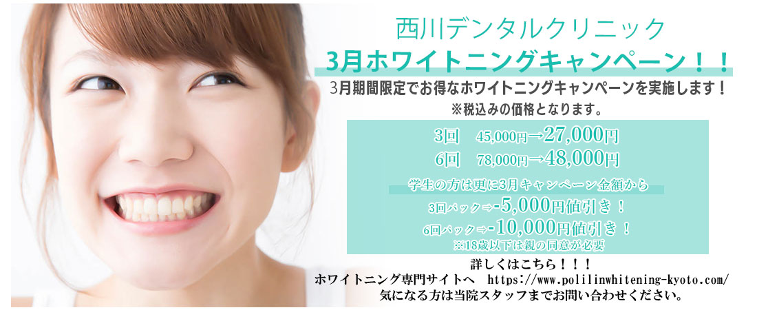 3月ホワイトニングキャンペーン！！