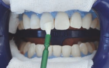 2．リアクター塗布