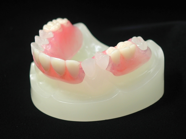 ノンクラスプデンチャー