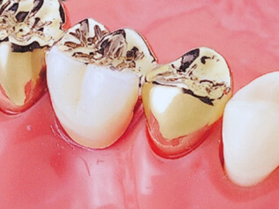 14Kゴールドコア