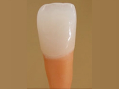 ファイバーコア