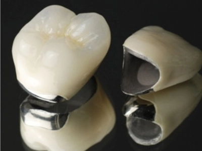 ハイグレードメタルボンド