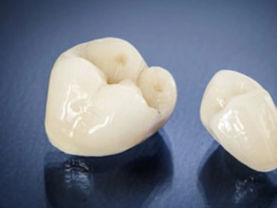 イージーホワイト冠