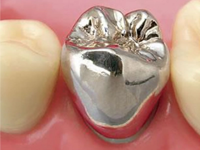 金銀パラジウム合金