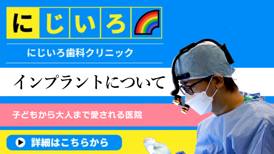 インプラントについて