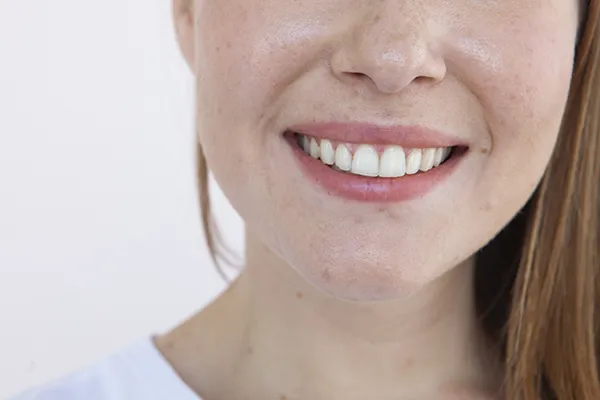 詰め物・被せ物