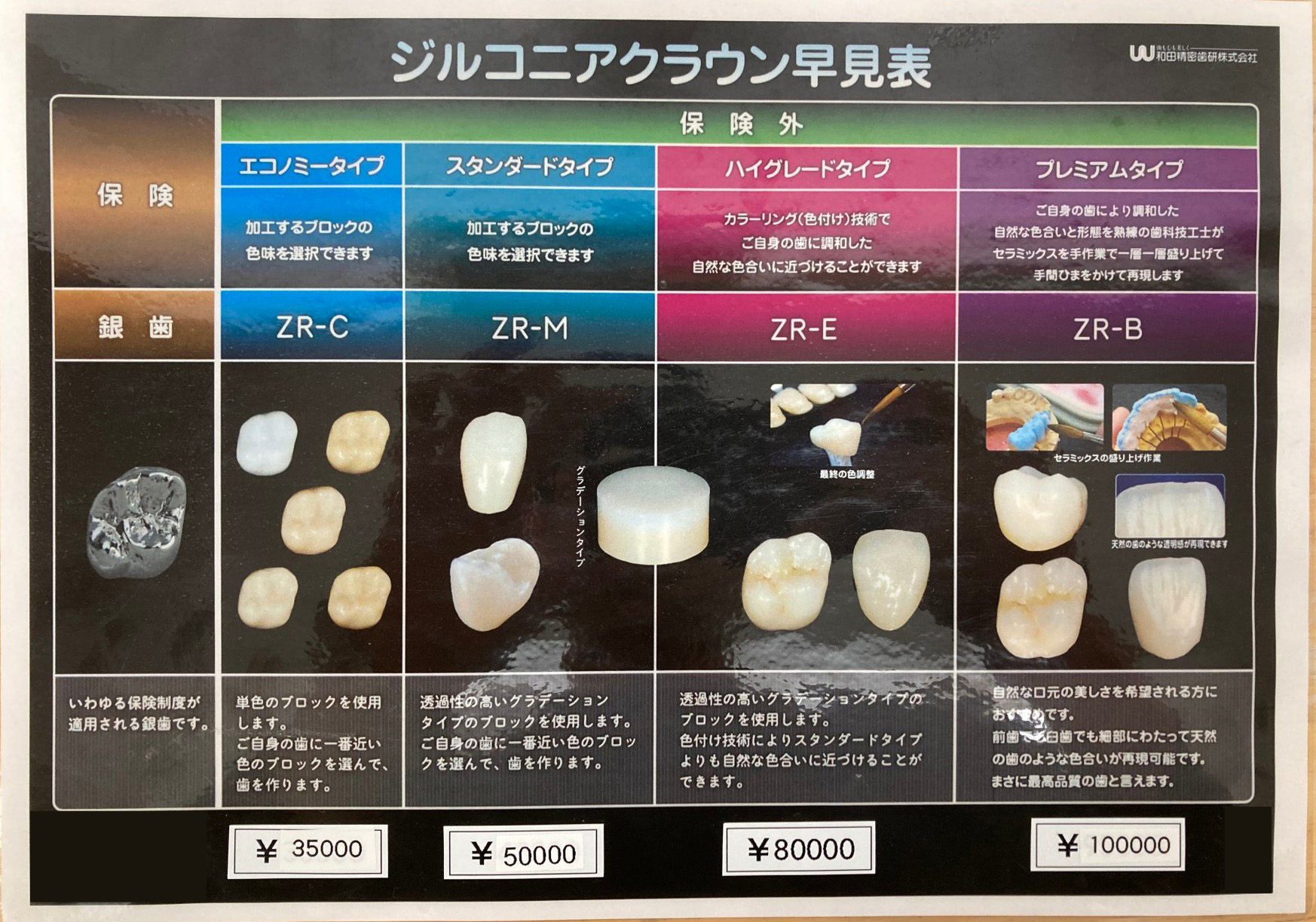 ジルコニアクラウン早見表