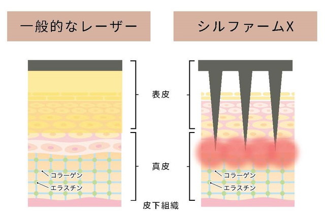 シルファームの特徴