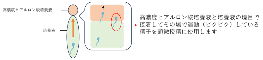 ヒアルロン酸を用いた生理学的精子選択術