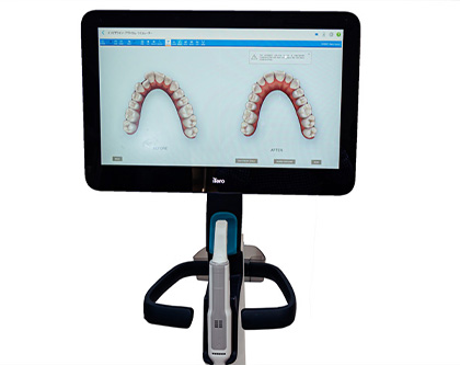 ３Ⅾ口腔内スキャナー