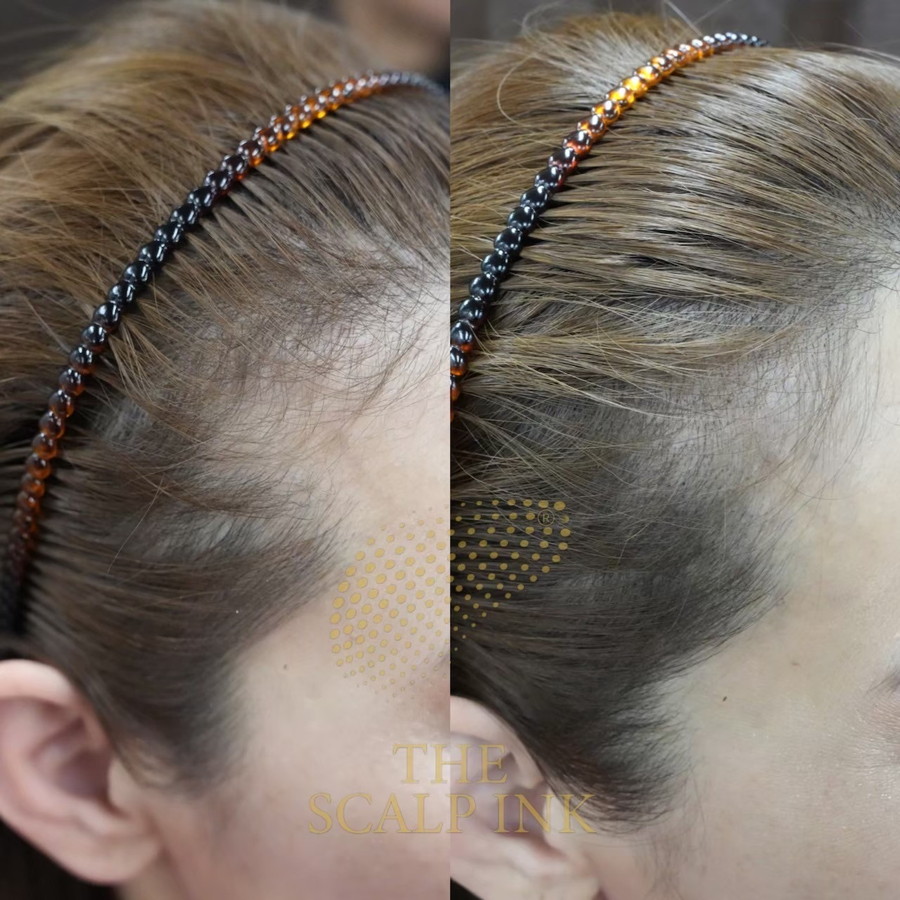 スカルプインク Before / After