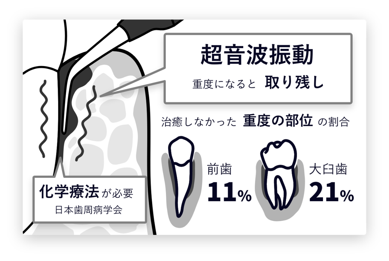 従来の方法（超音波振動のみ）