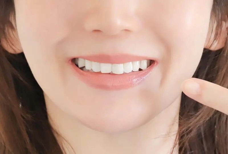 審美歯科