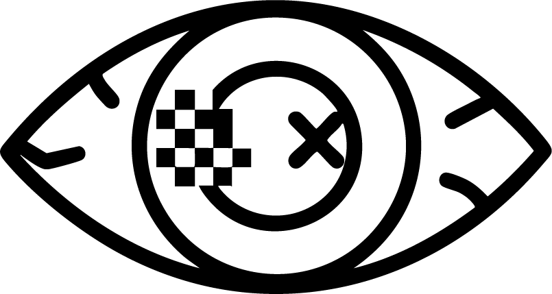 網膜静脈閉塞症