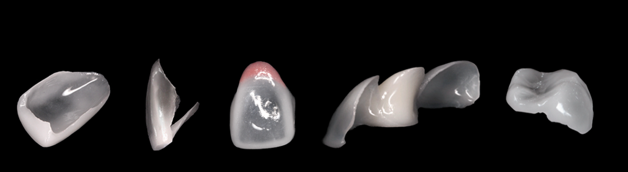 ミニッシュチップのイメージ