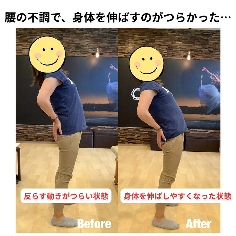 腰の不調で、身体を伸ばすのがつらかった…／ビフォーアフター