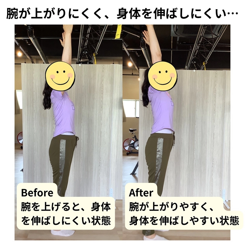 腕が上がりにくく、身体を伸ばしにくい…／ビフォーアフター