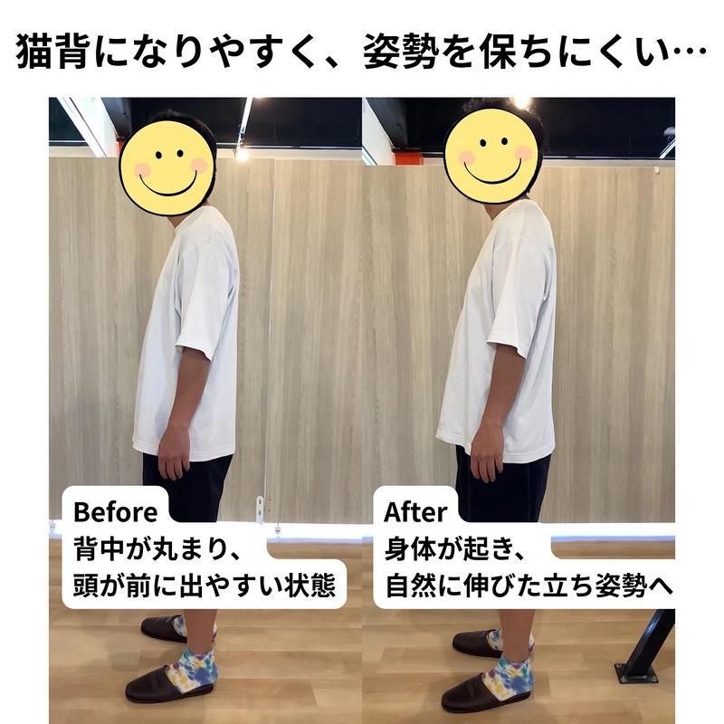 猫背になりやすく、姿勢を保ちにくい…／ビフォーアフター