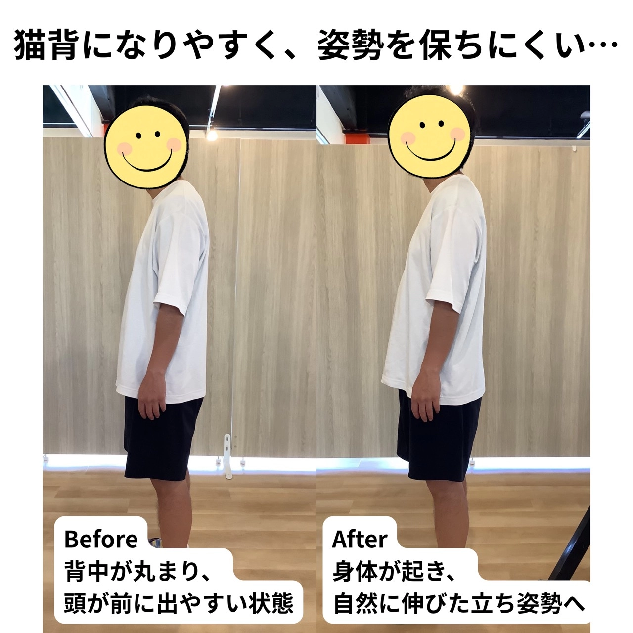 猫背になりやすく、姿勢を保ちにくい…／ビフォーアフター