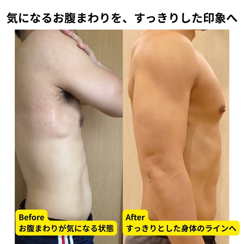気になるお腹まわりを、すっきりした印象へ／ビフォーアフター