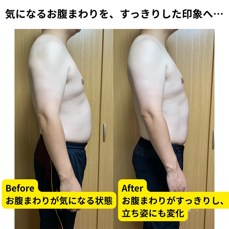 気になるお腹まわりを、すっきりした印象へ…／ビフォーアフター