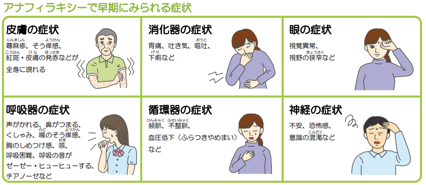 アナフィラキシーで早期にみられる症状