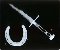 放射線検査イメージ3