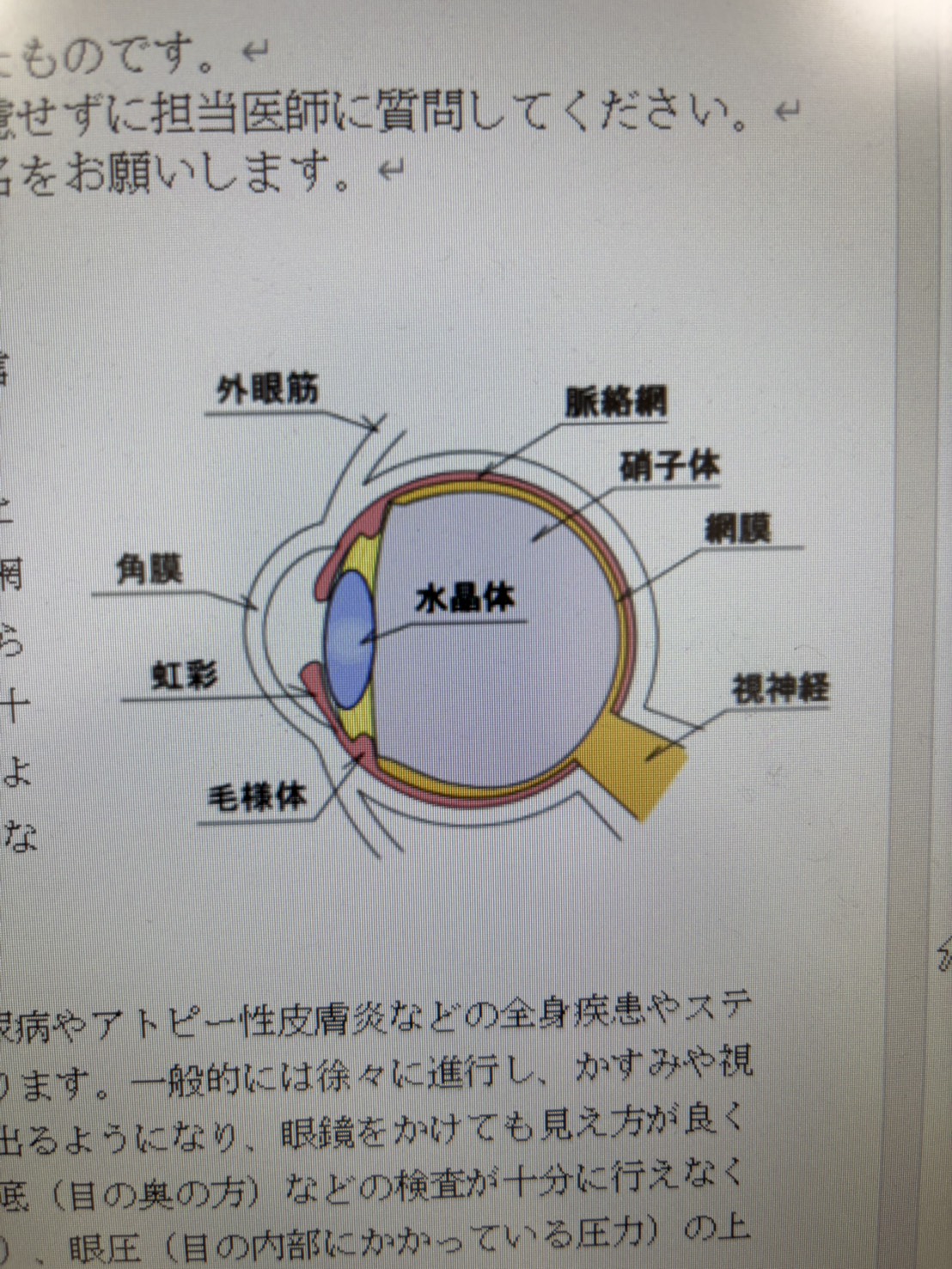 白内障手術イメージ1