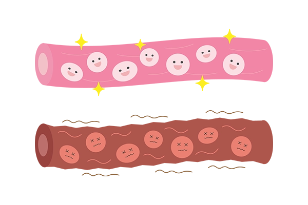 健康な血管と傷んだ血管を比べたイラスト