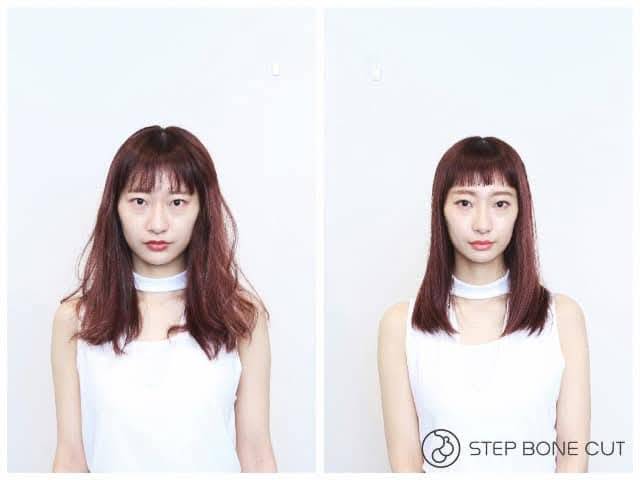 STEP BONE CUT ビフォーアフター 正面