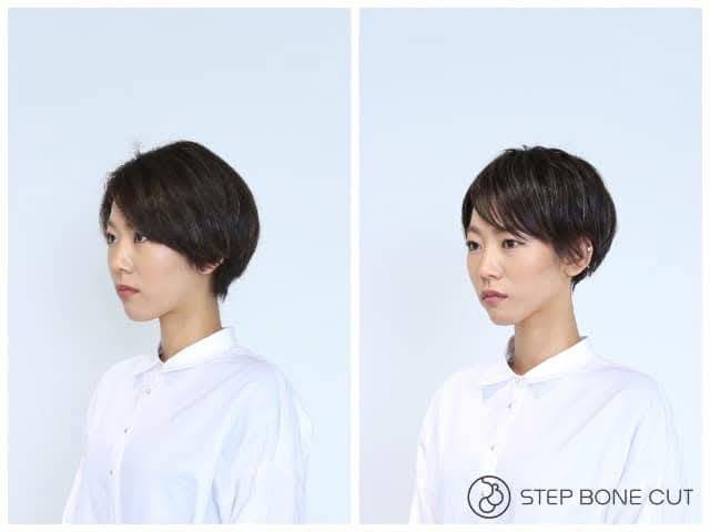 STEP BONE CUT ビフォーアフター 横顔