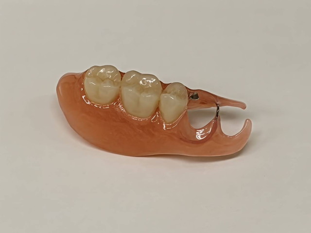 歯を失った方の治療